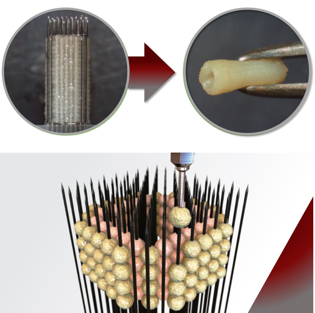 Solid Organ Bioprinting: Strategies to Achieve Organ